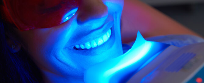 Professional vs. At-Home Teeth Whitening: Your Guide